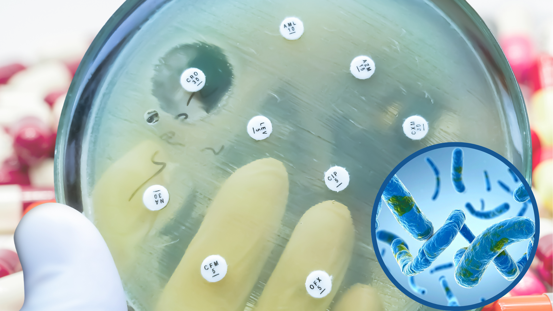 10 million people worldwide have active tb ~ the infectious form of tuberculosis (23)