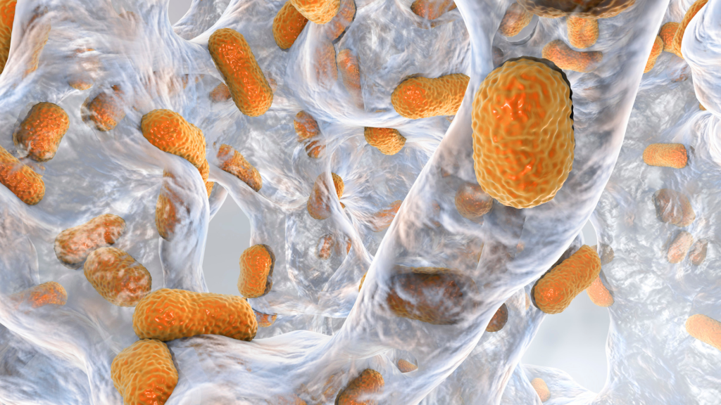 10 million people worldwide have active tb ~ the infectious form of tuberculosis (36)